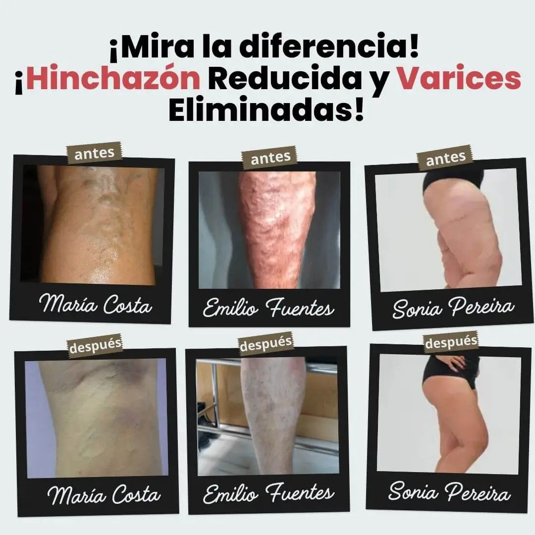 Oferta 1par + 1par Gratis Medias de acupresión Anti-Varices