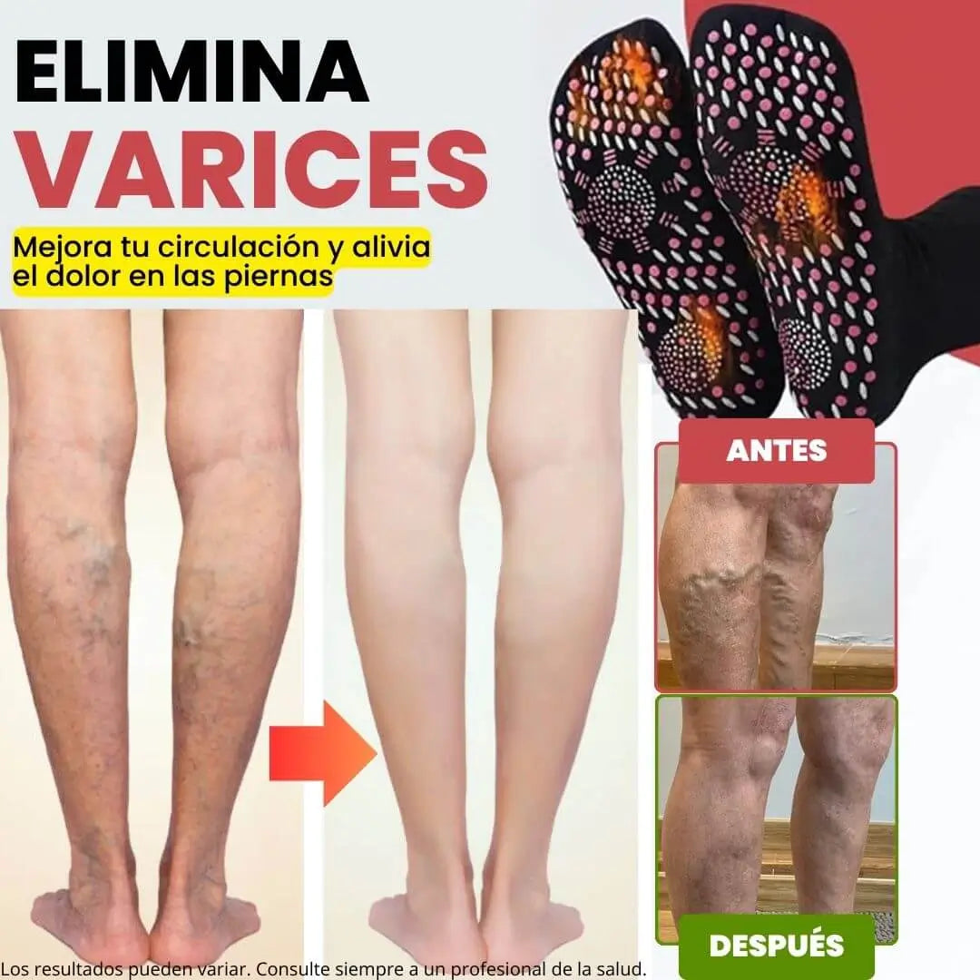 Oferta 1par + 1par Gratis Medias de acupresión Anti-Varices